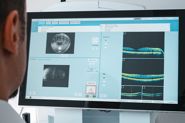 Messgerät OCT Augenarzt Untersuchung